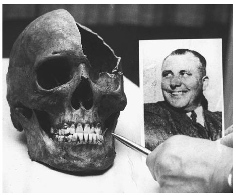 Genetic testing showed that this skull belonged to Martin Bormann, Hitler's private secretary. Bormann, who was missing and sentenced in absentia for war crimes at the Nuremberg trials of 1946, is shown in the photo at right. AP/WIDE WORLD PHOTOS.